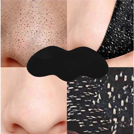 Blackhead Remover Patch with Activated Charcoal - 10-Unit Kit